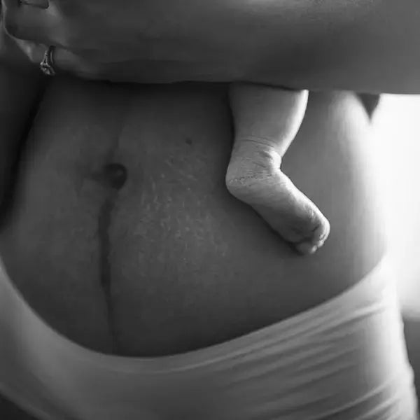 postpartum body